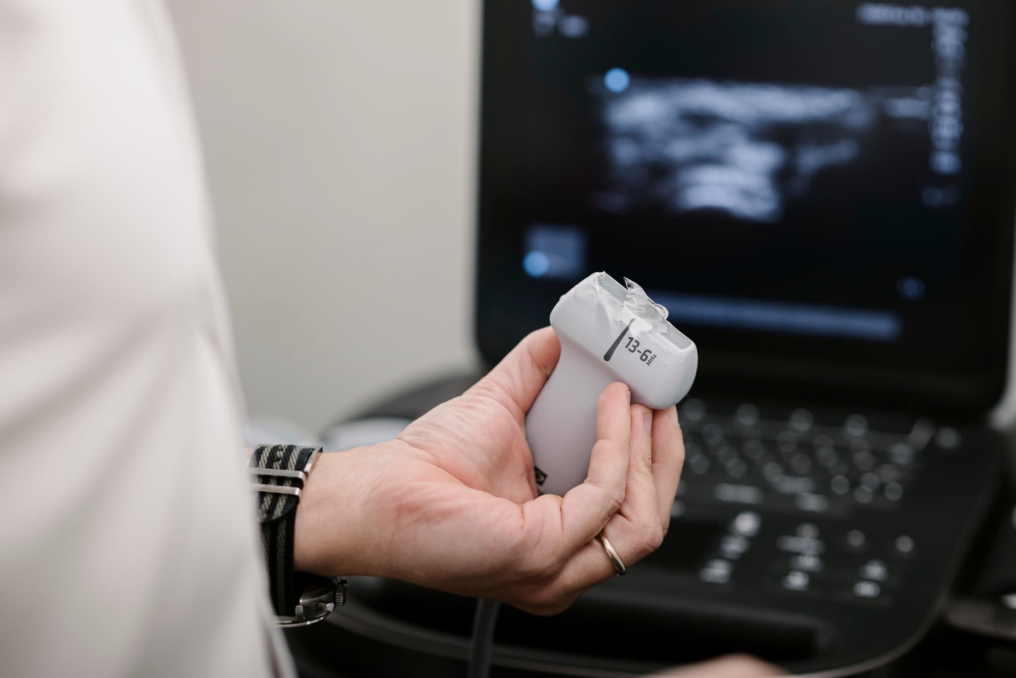 Transdutor de ultrassonografia point-of-care utilizado durante o exame físico no Instituto Trindade Castro